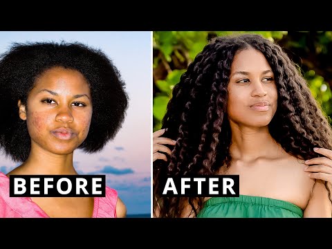 Before & After My Vegan Diet AND What I’m Doing Now | My Transformation Story
