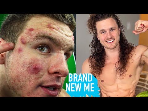 Turning Vegan Cured My Cystic Acne | BRAND NEW ME