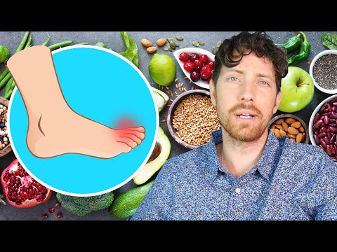 Vegan Diet vs Gout: Home Remedy?